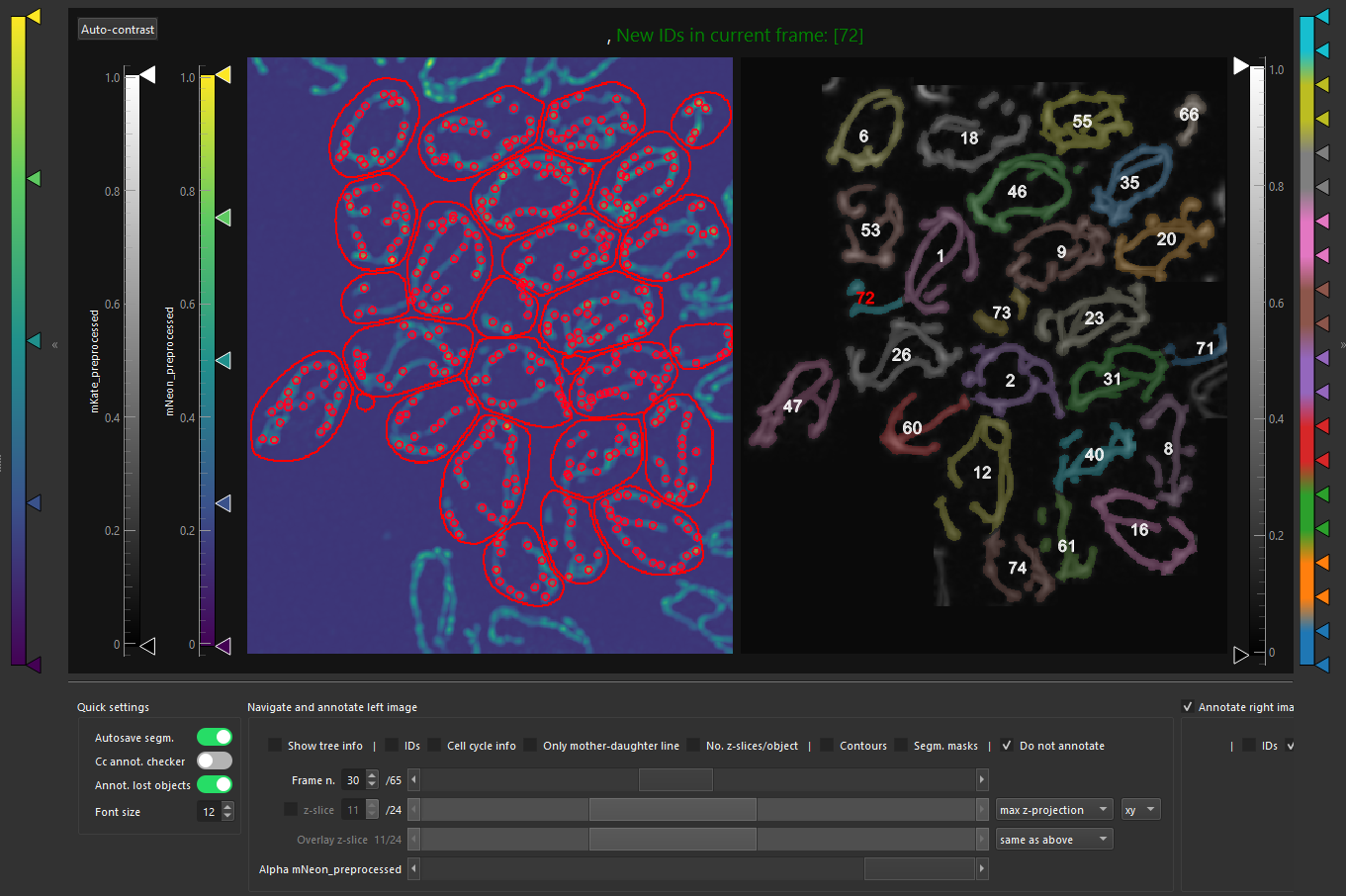 Timelpase microscopy of <i>S. cerevisiae</i> with detection of mitochondrial DNA and segmetnation of mitochondrial network. Dataset by Dr. Padovani F., Helmholtz Munich, Germany